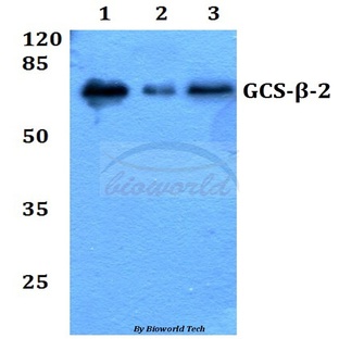 GCS-(beta)-2 (V102) pAb