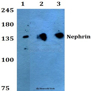 Nephrin (H892) pAb