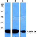 RANTES (Y84) pAb