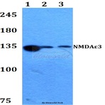 NMDAE3 (P986) pAb