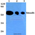 Smad6 (N372) pAb