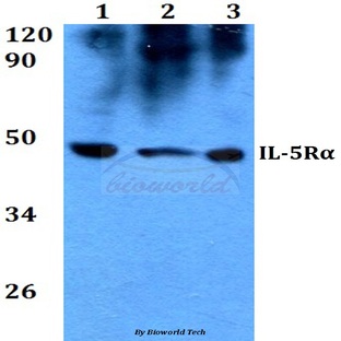 IL-5R(alpha) (K68) pAb