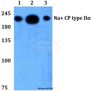 Na+ CP type II(alpha) (K1032) pAb