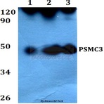 PSMC3 (V306) pAb