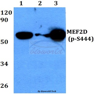 p-MEF2D (S444) pAb