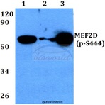 p-MEF2D (S444) pAb