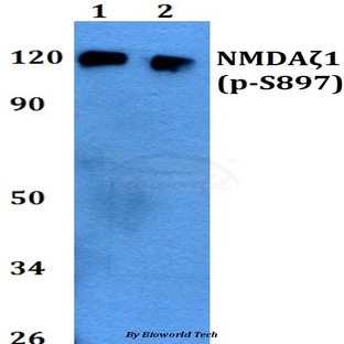 p-NMDA?1 (S897) pAb