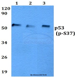 p-p53 (S37) pAb