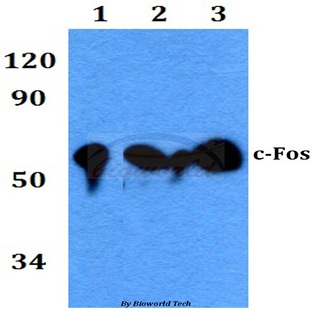 c-Fos (A356) pAb