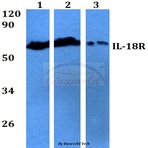 IL-18R (M270) pAb