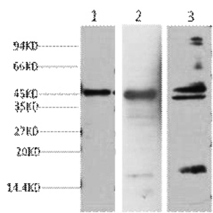 Aquaporin 4 Monoclonal Antibody