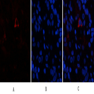 AR Polyclonal Antibody