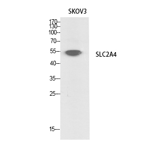 Glut4 Polyclonal Antibody