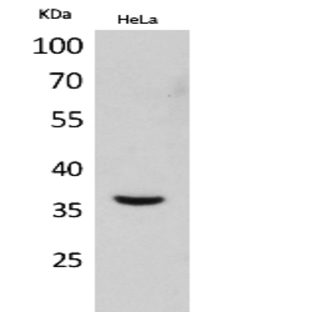 Mcl-1 Polyclonal Antibody