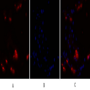 NF?B-p105/p50 Polyclonal Antibody