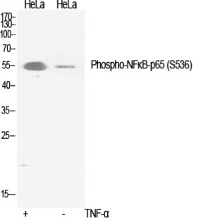 NF?B-p65 (phospho Ser536) Polyclonal Antibody