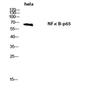 NF?B-p65 Polyclonal Antibody