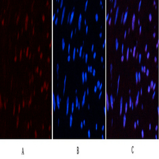 CD10 Monoclonal Antibody