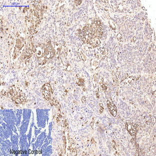 CD15 Monoclonal Antibody