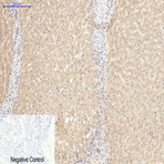 CD20 Monoclonal Antibody