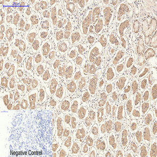 CD21 Monoclonal Antibody