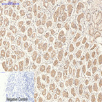 CD21 Monoclonal Antibody