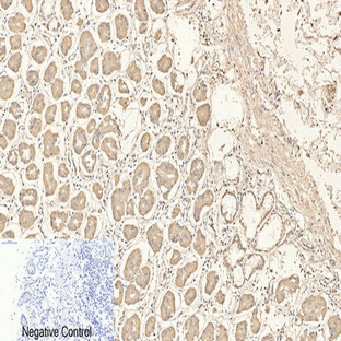 CD4 Monoclonal Antibody