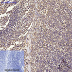 CD68 Monoclonal Antibody