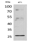 CD81 Polyclonal Antibody