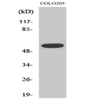 Akt (phospho Thr308) Polyclonal Antibody