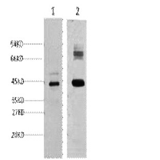 AMACR Monoclonal Antibody