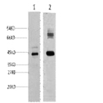 AMACR Monoclonal Antibody