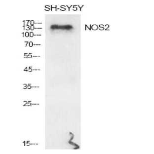 NOS2 Polyclonal Antibody