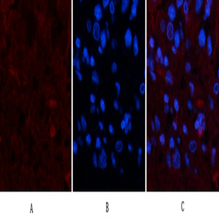 TTR Mouse Monoclonal Antibody(1D7)