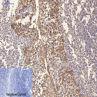 CK16 Monoclonal Antibody