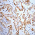 CK7 Monoclonal Antibody