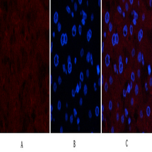 Collagen IV Mouse Monoclonal Antibody(8E5)