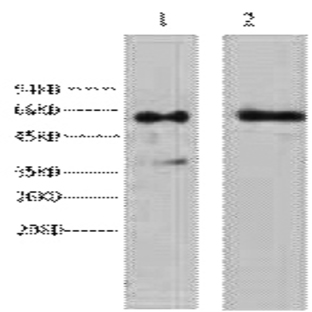 Cytokeratin 6 Monoclonal Antibody