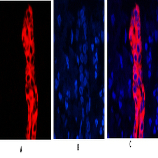 Cytokeratin 19 Polyclonal Antibody