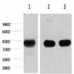 ? skeletal muscle actin Monoclonal Antibody