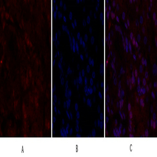 BRCA1 Polyclonal Antibody