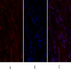 BRCA1 Polyclonal Antibody