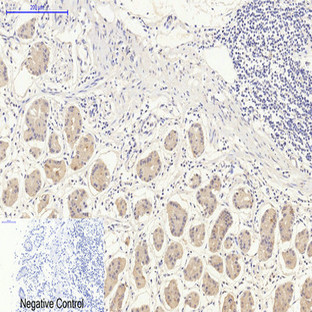 CHOP Mouse Monoclonal Antibody(2B1)