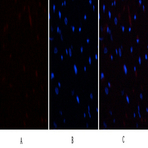 E2F-1 Polyclonal Antibody