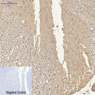 HDAC1 Mouse Monoclonal Antibody(4E1)