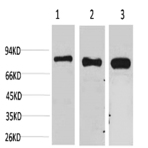 p70 S6 kinase ? Polyclonal Antibody