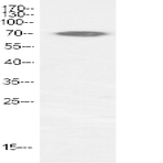 p70 S6 kinase ? Polyclonal Antibody