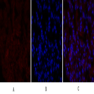 PERK Polyclonal Antibody