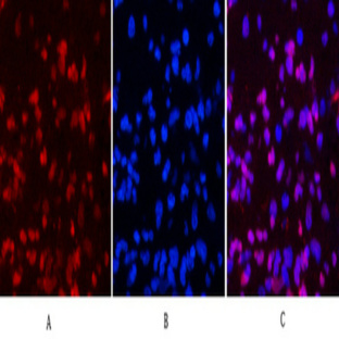 PR Monoclonal Antibody