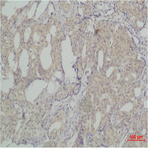 SLUG Polyclonal Antibody